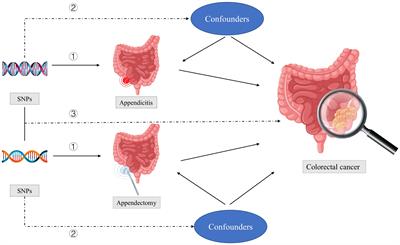 Appendectomy and appendicitis do not increase colorectal cancer risk: evidence from Mendelian randomization